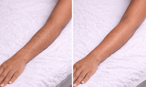 Professional arm waxing service for women in Orlando, Florida, leaving the skin smooth, clean, and hair-free